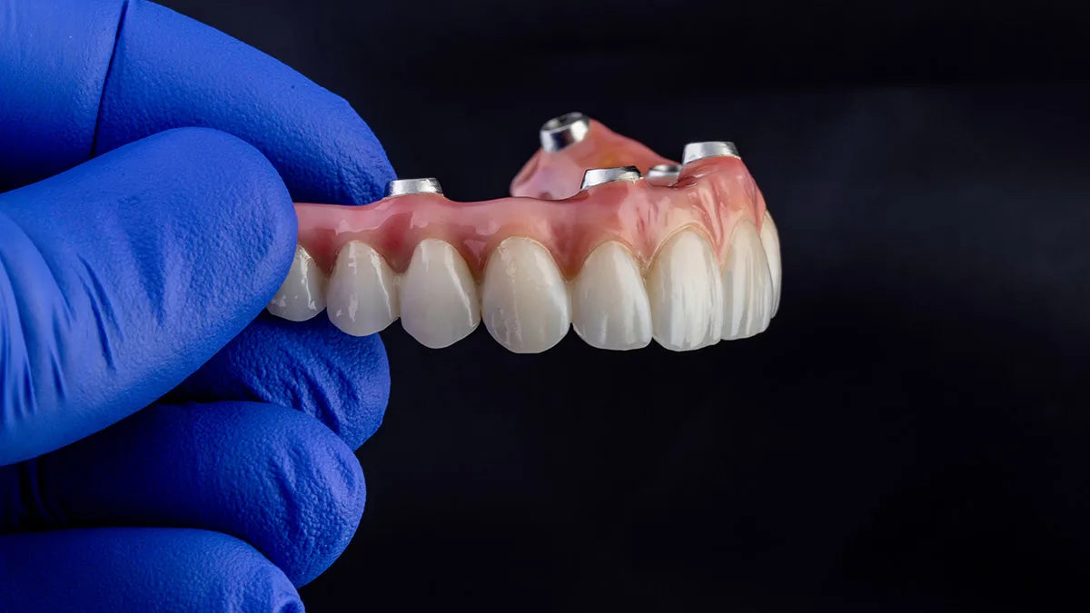 Overdenture