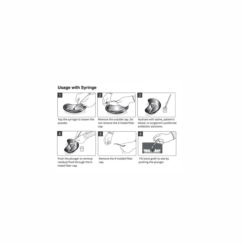 OsseoSeal Mineralized Cortico-Cancellous (50/50) Bone in Syringe [1cc:2x0.5cc]